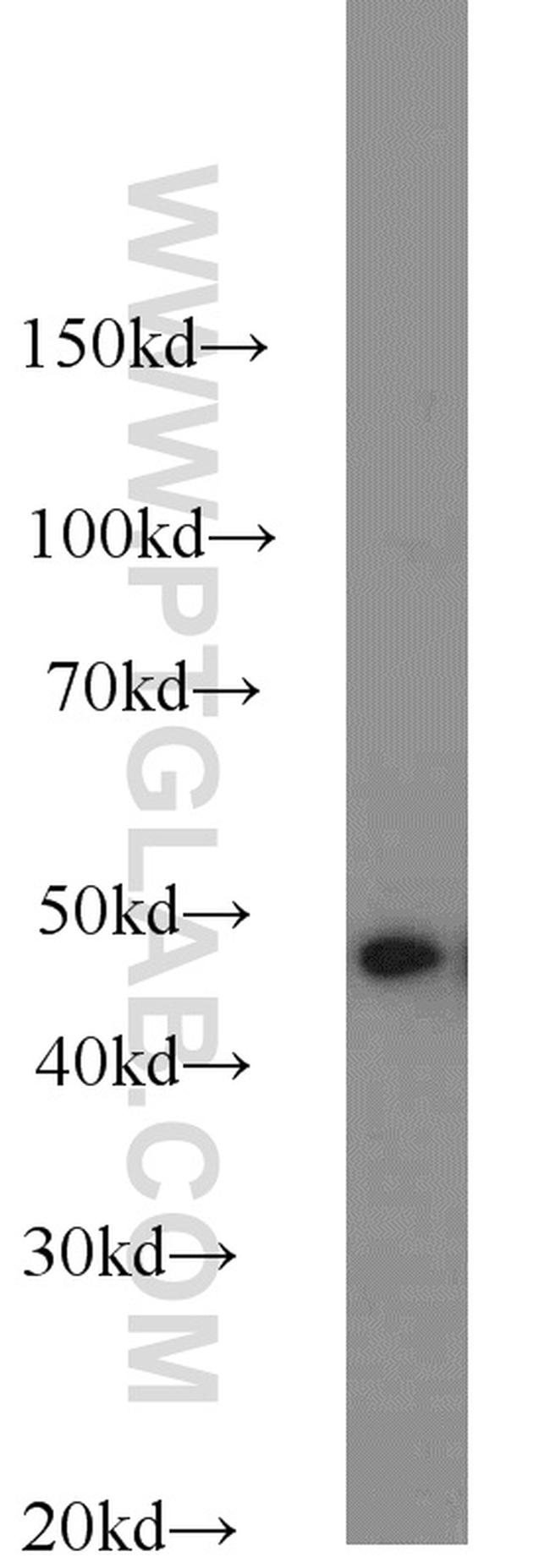 SNX6 Antibody in Western Blot (WB)