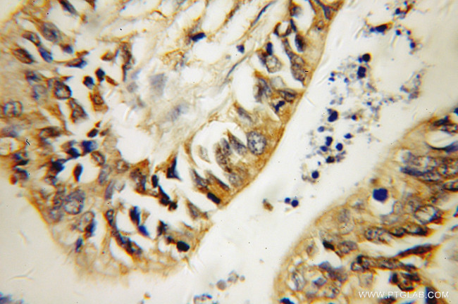 GDI2 Antibody in Immunohistochemistry (Paraffin) (IHC (P))