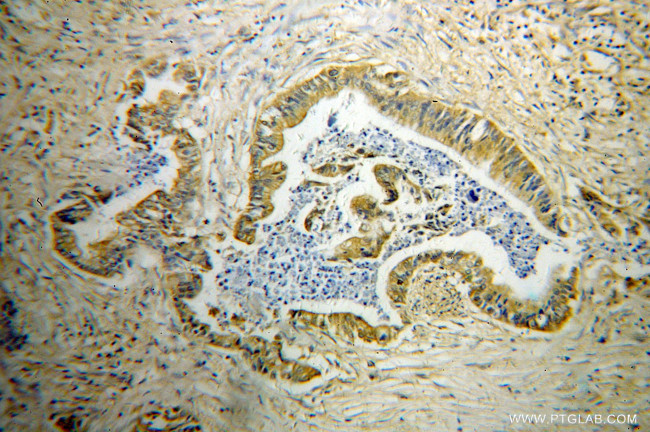 GDI2 Antibody in Immunohistochemistry (Paraffin) (IHC (P))