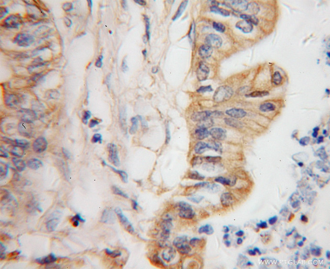 GDI2 Antibody in Immunohistochemistry (Paraffin) (IHC (P))