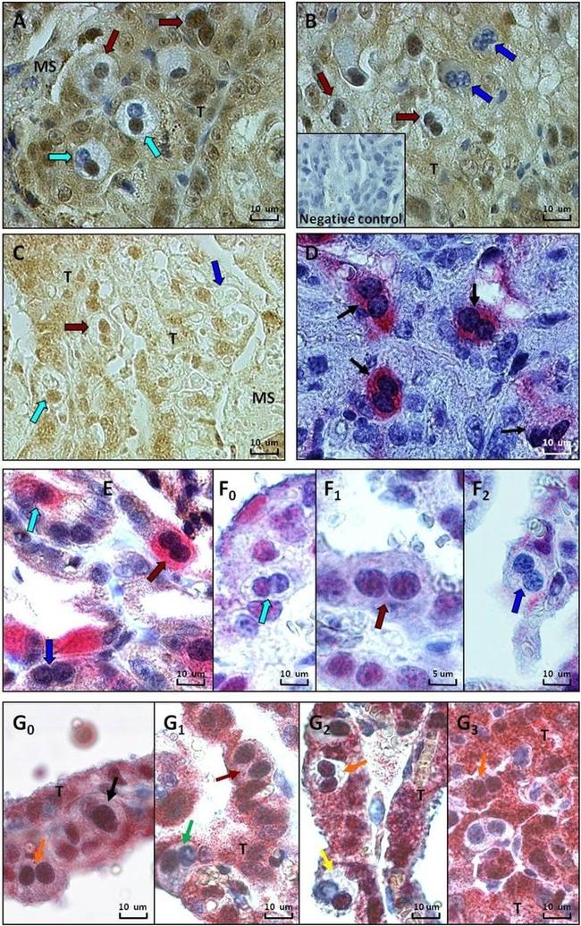 Glucocorticoid Receptor Antibody in Immunohistochemistry (IHC)