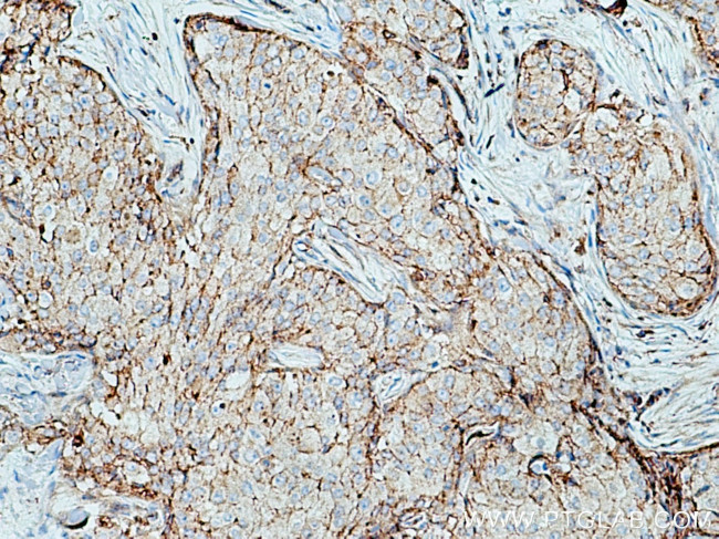 Claudin 7 Antibody in Immunohistochemistry (Paraffin) (IHC (P))