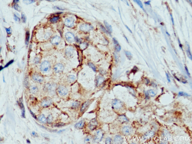 Claudin 7 Antibody in Immunohistochemistry (Paraffin) (IHC (P))