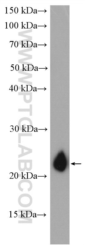 Claudin 7 Antibody in Western Blot (WB)