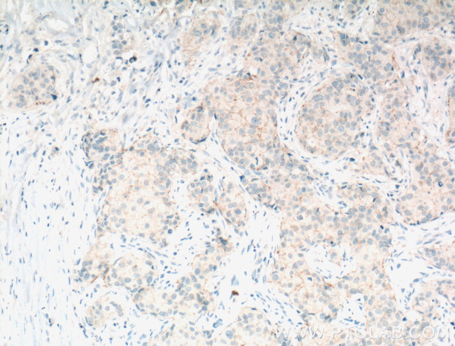 Claudin 7 Antibody in Immunohistochemistry (Paraffin) (IHC (P))