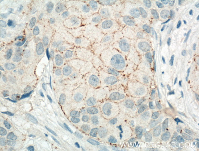 Claudin 7 Antibody in Immunohistochemistry (Paraffin) (IHC (P))