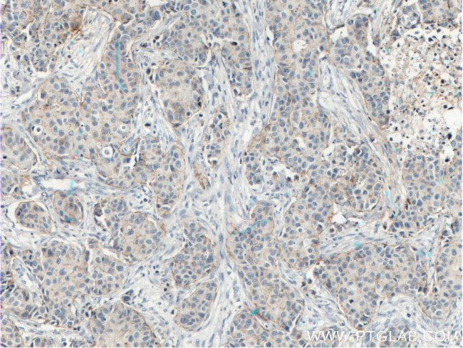 Claudin 7 Antibody in Immunohistochemistry (Paraffin) (IHC (P))