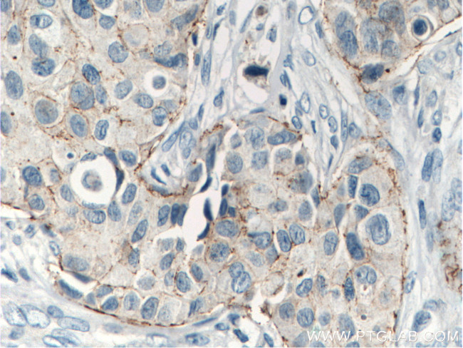 Claudin 7 Antibody in Immunohistochemistry (Paraffin) (IHC (P))