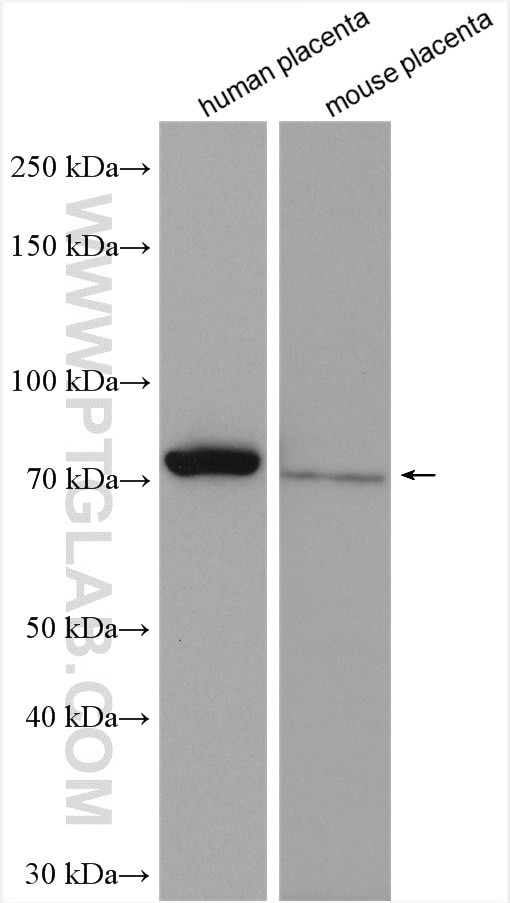 Calpain 6 Antibody in Western Blot (WB)