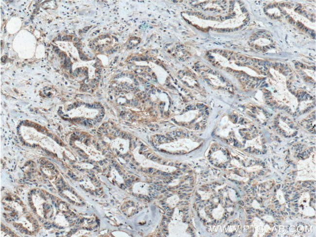 ICAM2 Antibody in Immunohistochemistry (Paraffin) (IHC (P))