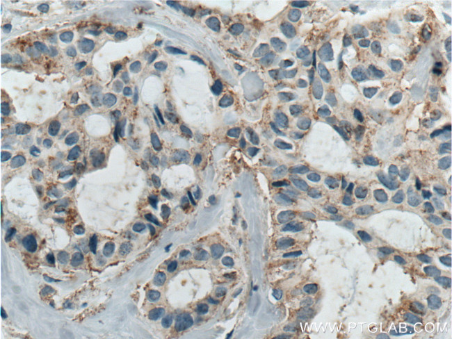 ICAM2 Antibody in Immunohistochemistry (Paraffin) (IHC (P))