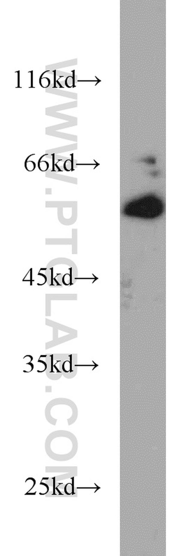 ICAM2 Antibody in Western Blot (WB)