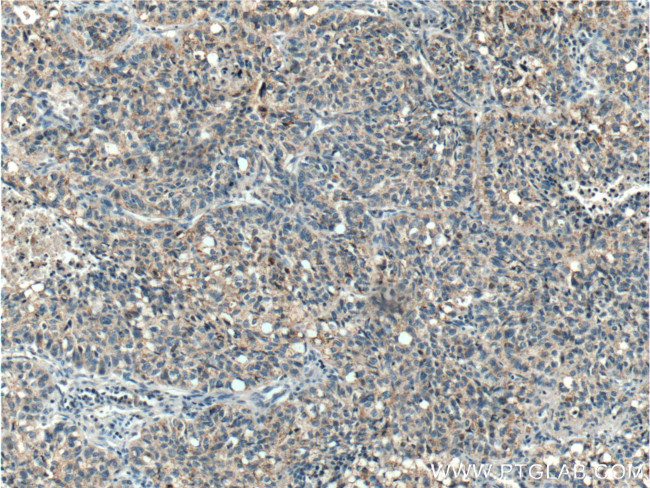 ICAM2 Antibody in Immunohistochemistry (Paraffin) (IHC (P))