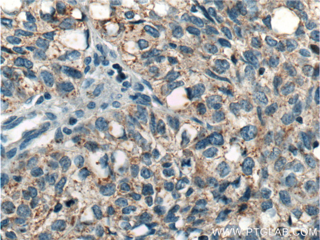 ICAM2 Antibody in Immunohistochemistry (Paraffin) (IHC (P))