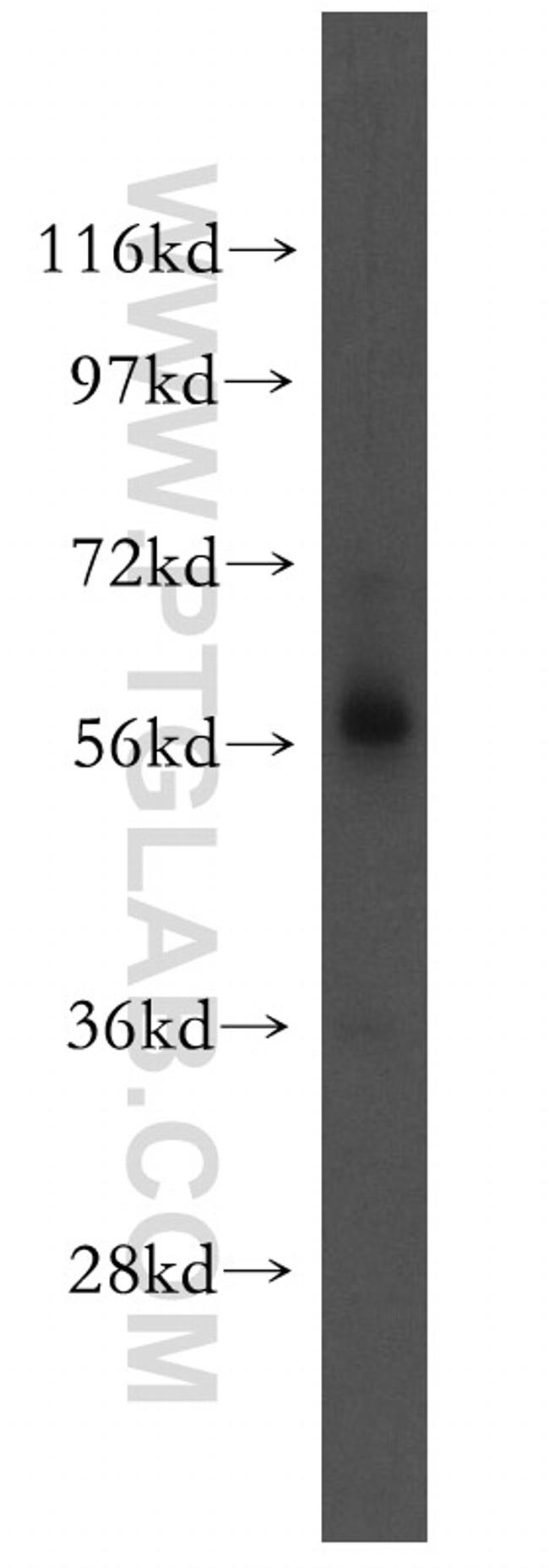 ICAM2 Antibody in Western Blot (WB)