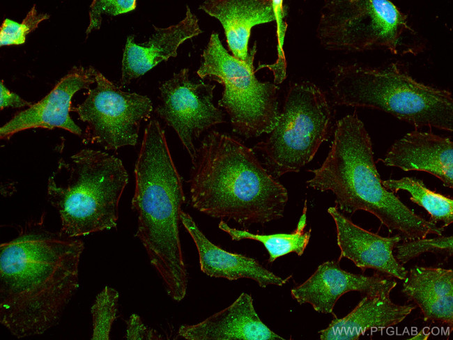 CDK2 Antibody in Immunocytochemistry (ICC/IF)