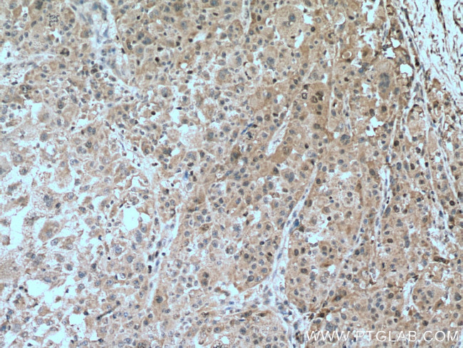 CDK2 Antibody in Immunohistochemistry (Paraffin) (IHC (P))