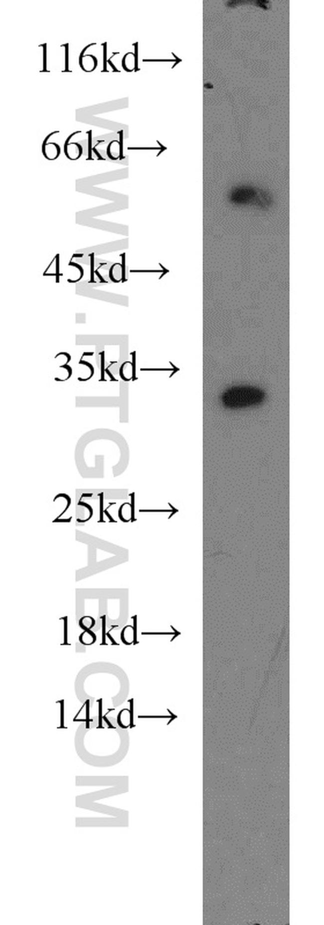 CDK2 Antibody in Western Blot (WB)