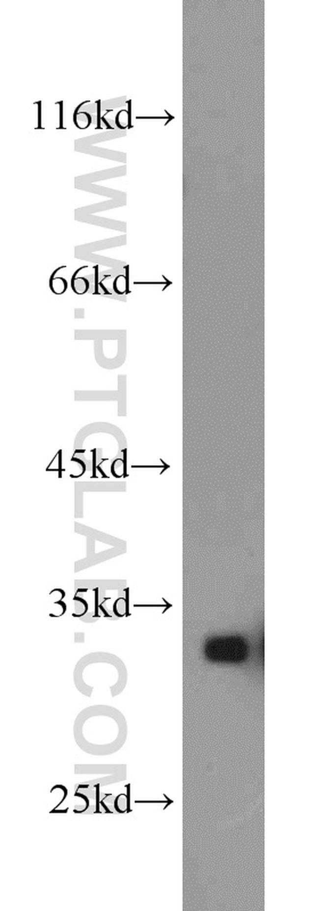 CDK2 Antibody in Western Blot (WB)