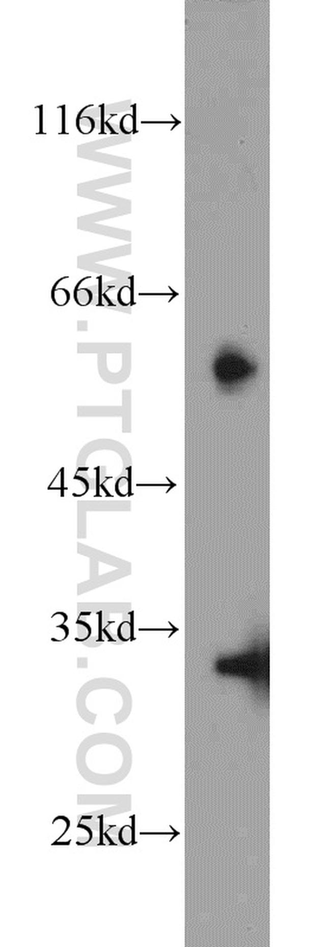 CDK2 Antibody in Western Blot (WB)