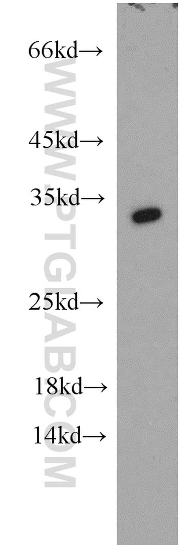 CDK2 Antibody in Western Blot (WB)