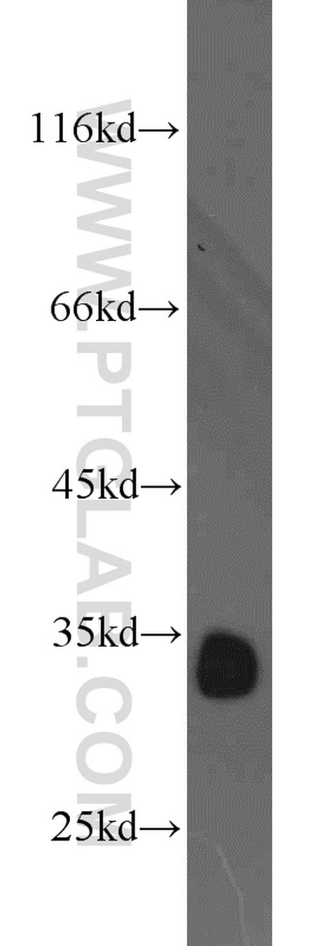 CDK2 Antibody in Western Blot (WB)