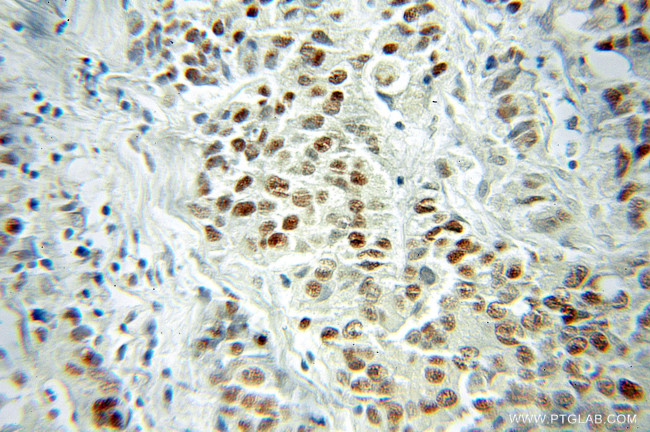 VGLL1 Antibody in Immunohistochemistry (Paraffin) (IHC (P))