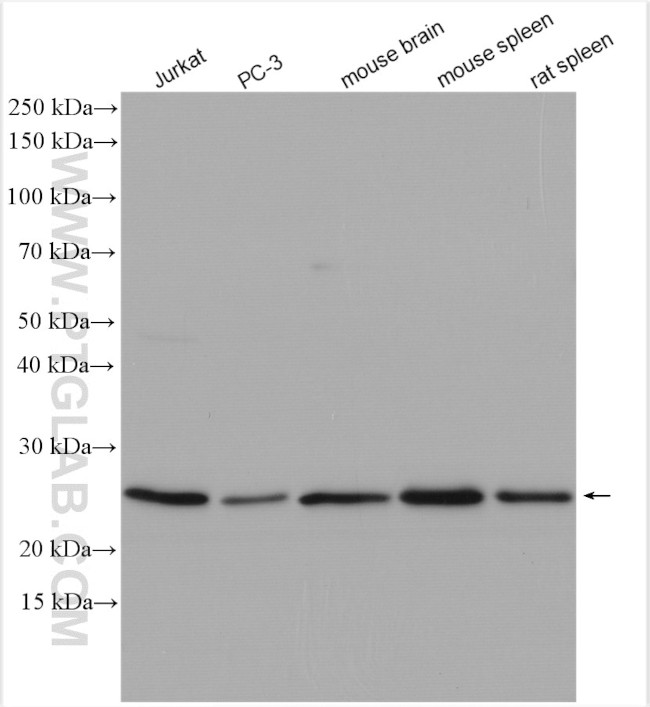 VGLL1 Antibody in Western Blot (WB)