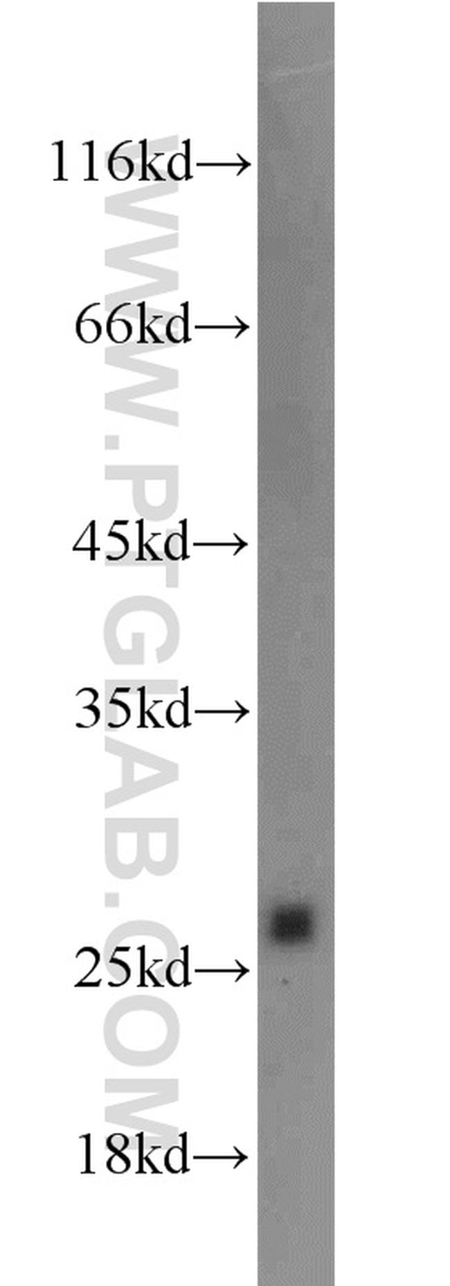 VGLL1 Antibody in Western Blot (WB)