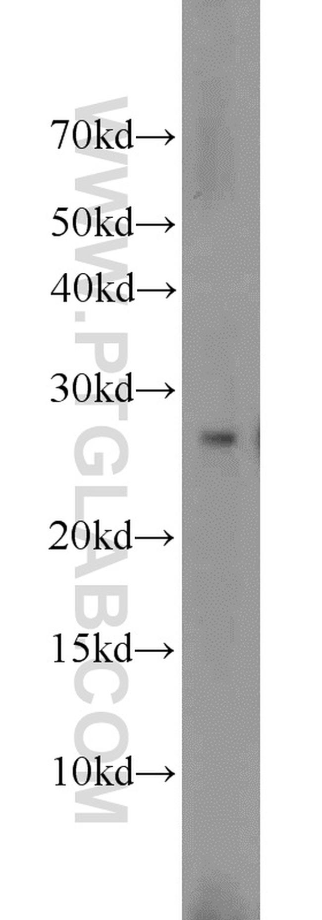 VGLL1 Antibody in Western Blot (WB)
