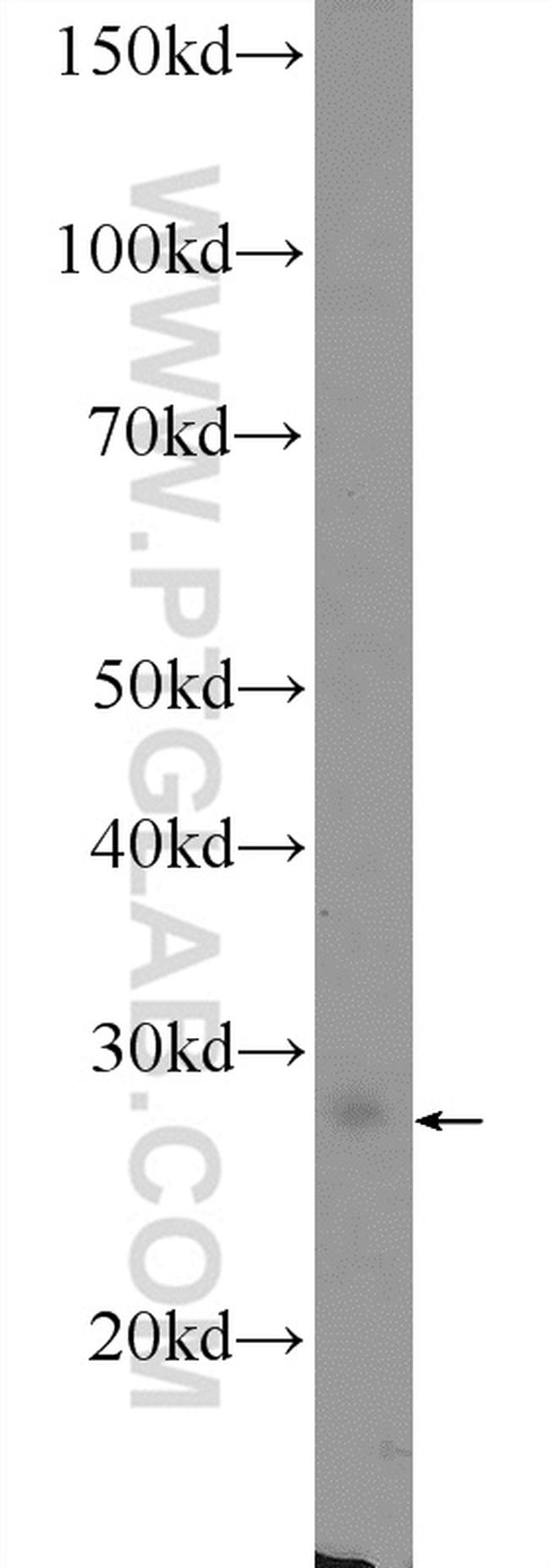 VGLL1 Antibody in Western Blot (WB)