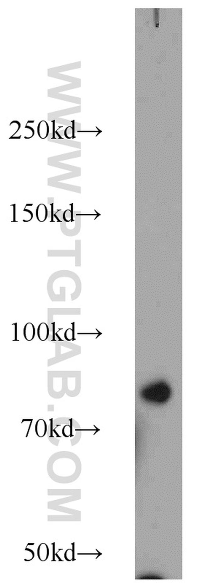 KIFC3 Antibody in Western Blot (WB)