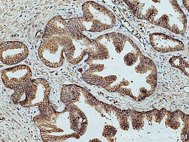 LRRC1 Antibody in Immunohistochemistry (Paraffin) (IHC (P))