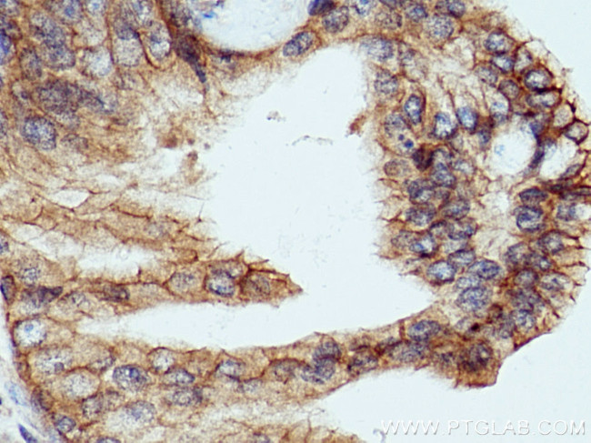 LRRC1 Antibody in Immunohistochemistry (Paraffin) (IHC (P))