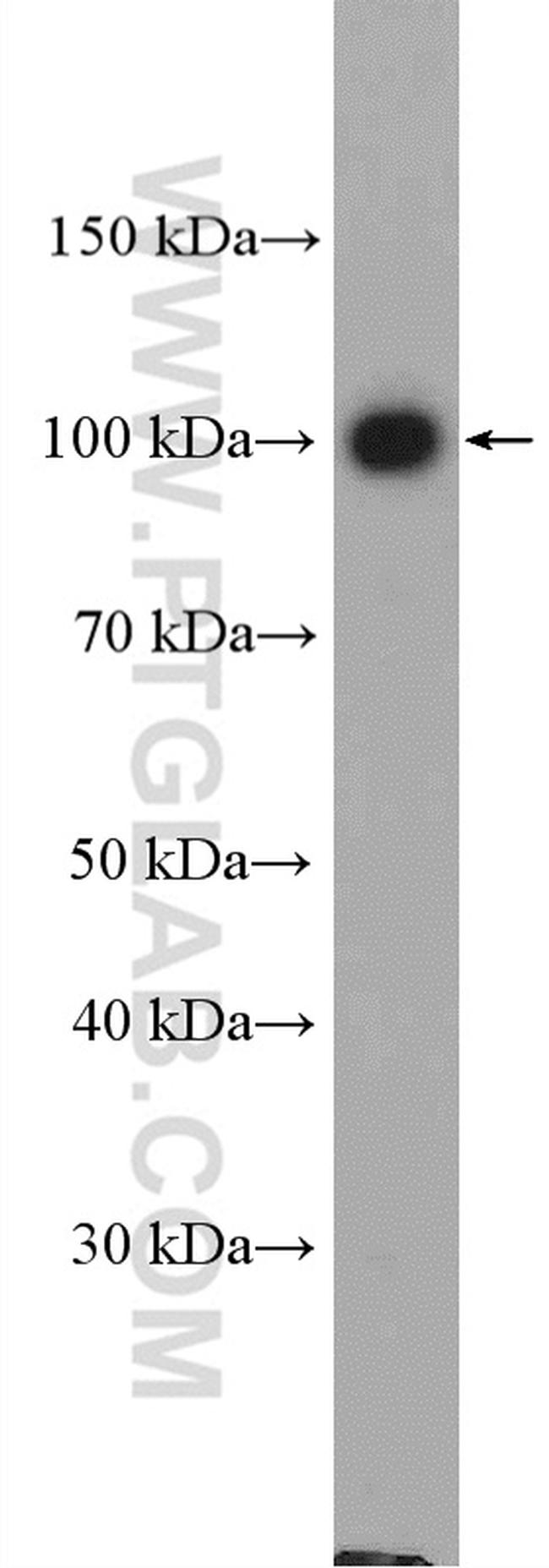 Adaptin Antibody in Western Blot (WB)