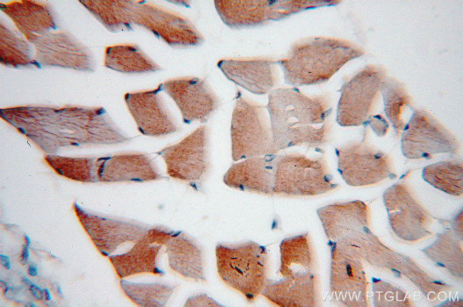 VAMP2 Antibody in Immunohistochemistry (Paraffin) (IHC (P))