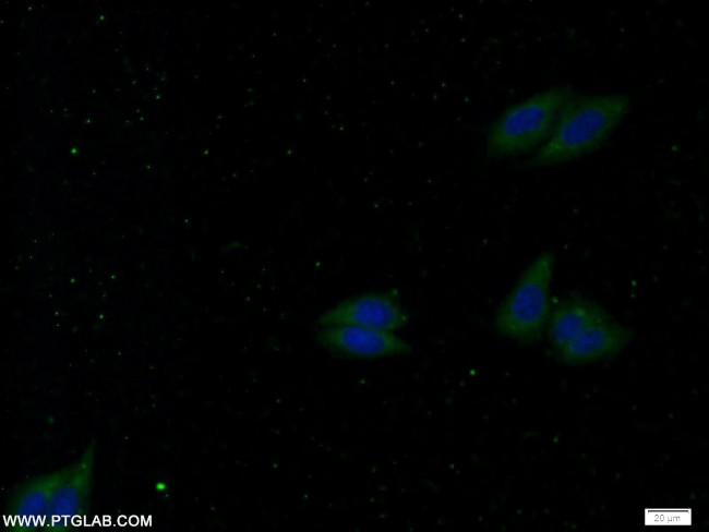 MNK1 Antibody in Immunocytochemistry (ICC/IF)