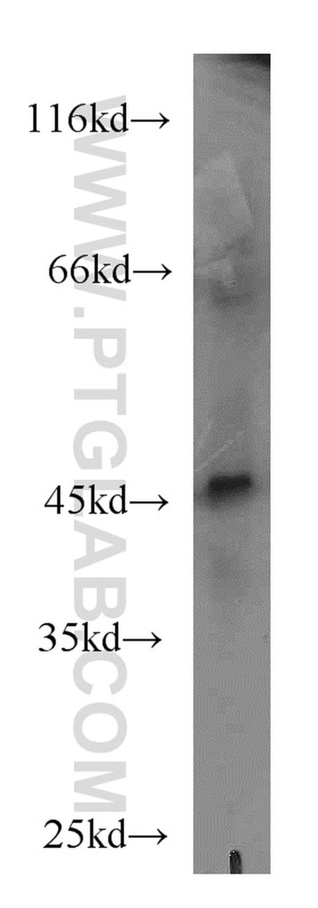 MNK1 Antibody in Western Blot (WB)