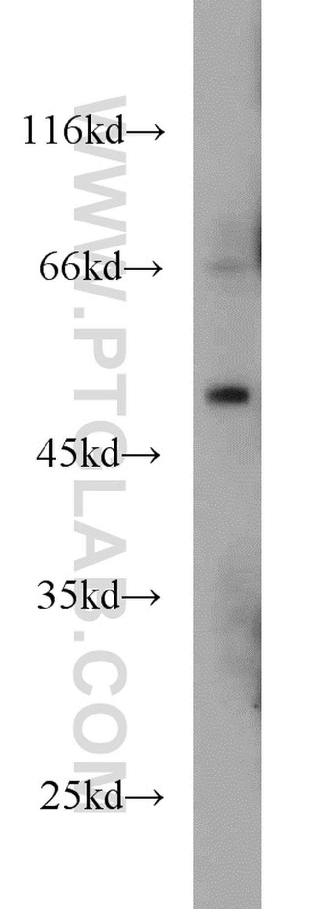 MNK1 Antibody in Western Blot (WB)