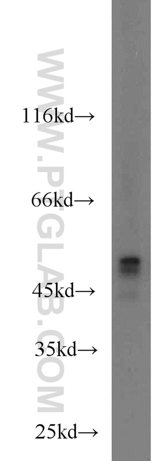 MNK1 Antibody in Western Blot (WB)