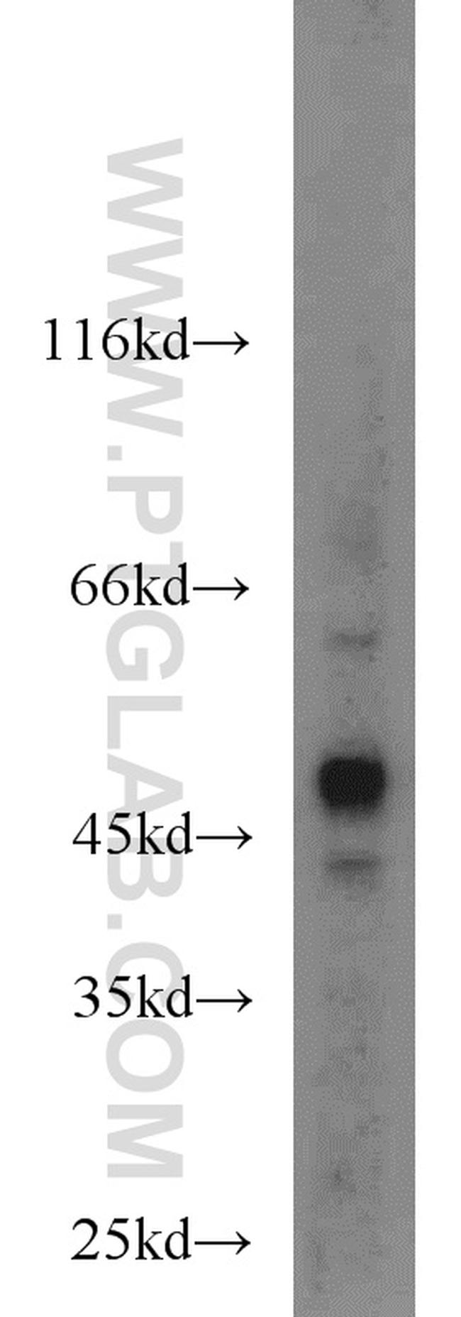 MNK1 Antibody in Western Blot (WB)