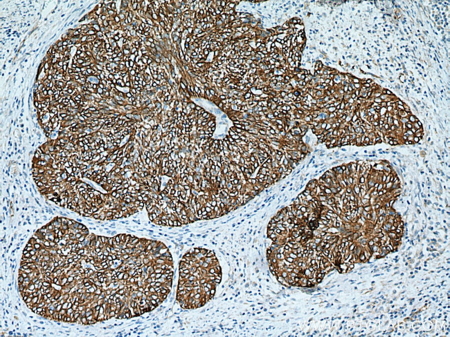 Cytokeratin 15 Antibody in Immunohistochemistry (Paraffin) (IHC (P))