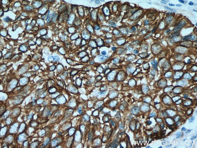 Cytokeratin 15 Antibody in Immunohistochemistry (Paraffin) (IHC (P))