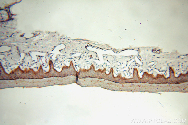 Cytokeratin 15 Antibody in Immunohistochemistry (Paraffin) (IHC (P))