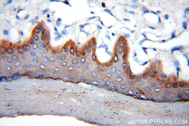 Cytokeratin 15 Antibody in Immunohistochemistry (Paraffin) (IHC (P))