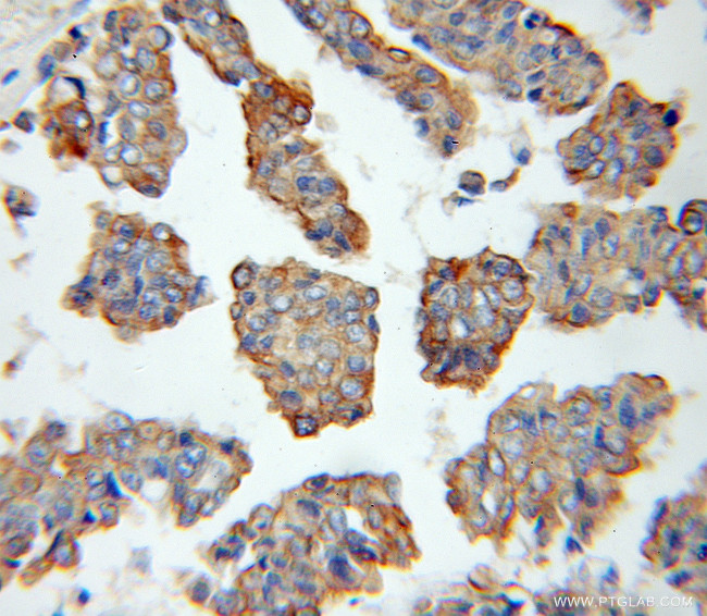 Cytokeratin 15 Antibody in Immunohistochemistry (Paraffin) (IHC (P))