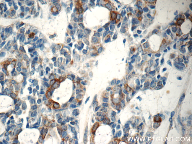 Cytokeratin 15 Antibody in Immunohistochemistry (Paraffin) (IHC (P))