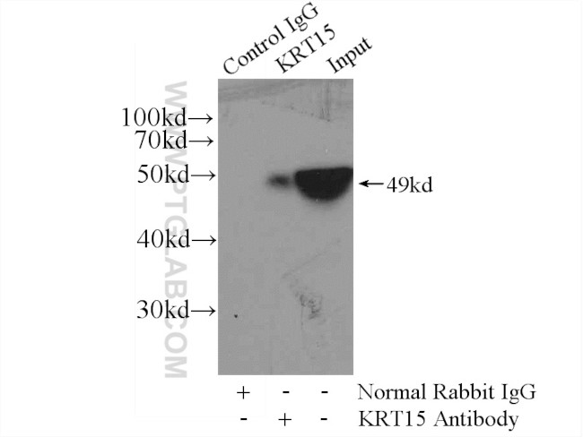 Cytokeratin 15 Antibody in Immunoprecipitation (IP)