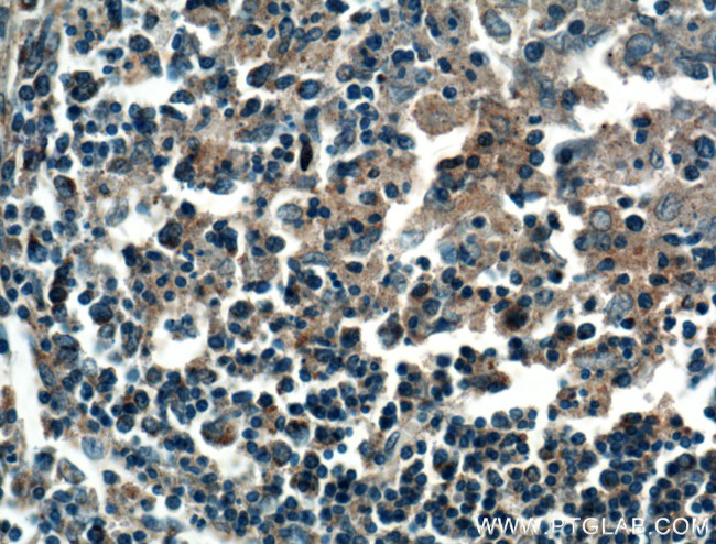 HVEM/TNFRSF14 Antibody in Immunohistochemistry (Paraffin) (IHC (P))