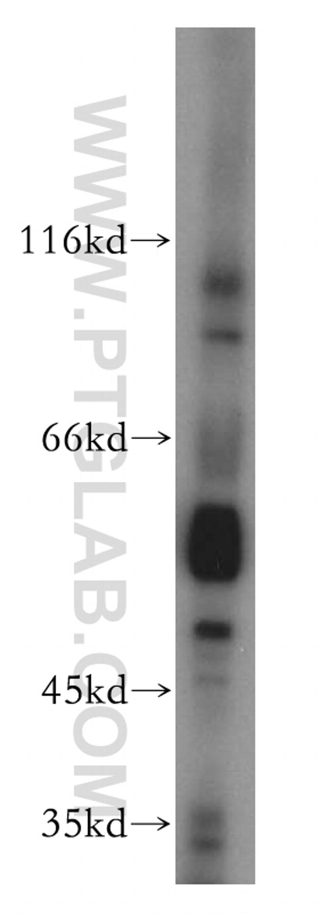 THRA Antibody in Western Blot (WB)